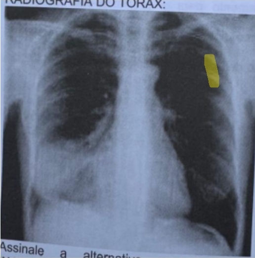 Imagem da Questão 4