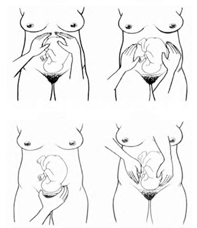 Figura 1 - Palpação obstétrica