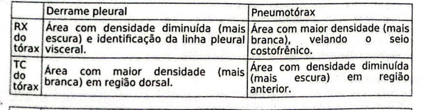 Tabela da alternativa A