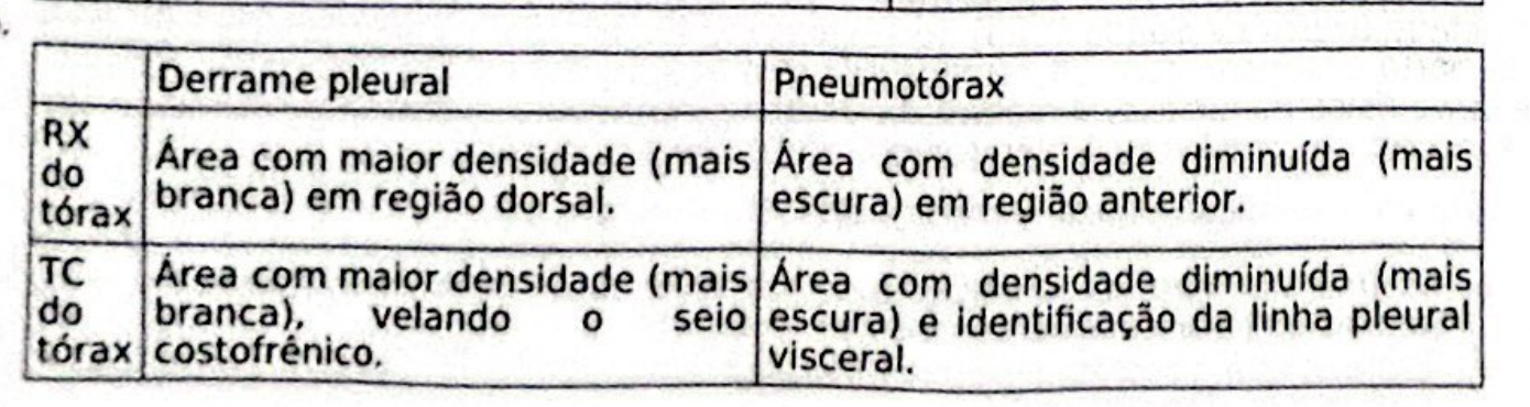 Tabela da alternativa B