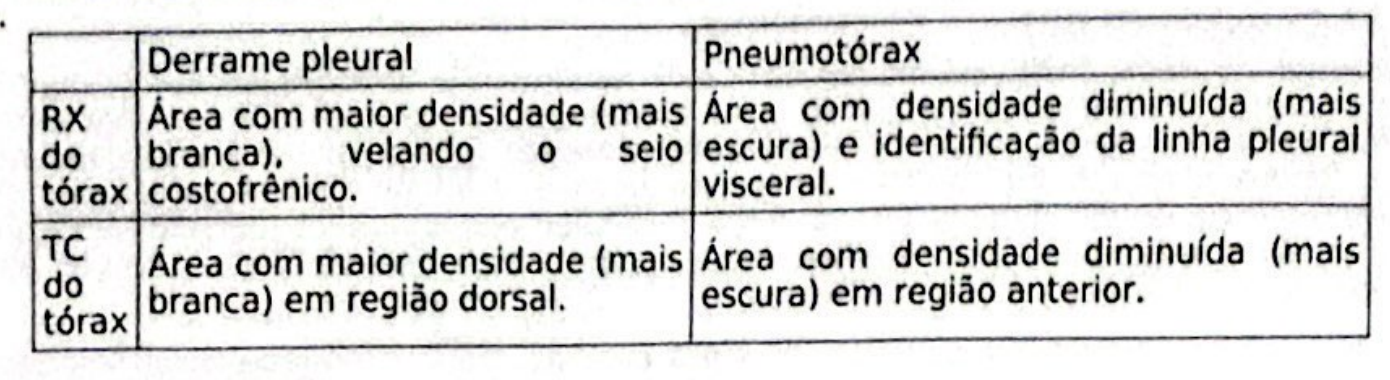 Tabela da alternativa E