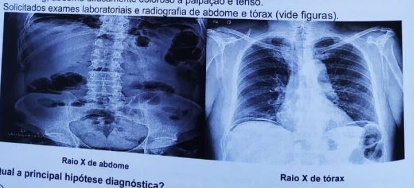 Imagem da Questão 35