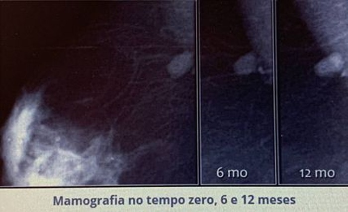 Imagem da Questão 44