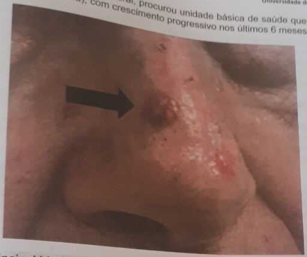 Imagem da Questão 33