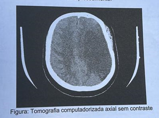 Imagem da Questão 38