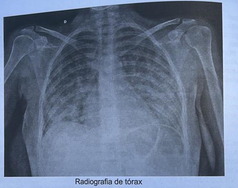 Imagem da Questão 51