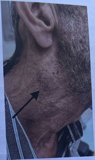 Imagem da Questão 97