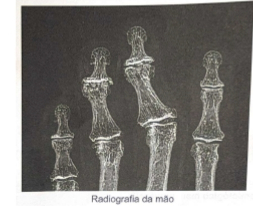 Imagem da Questão 99