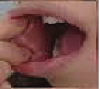 Imagem D.