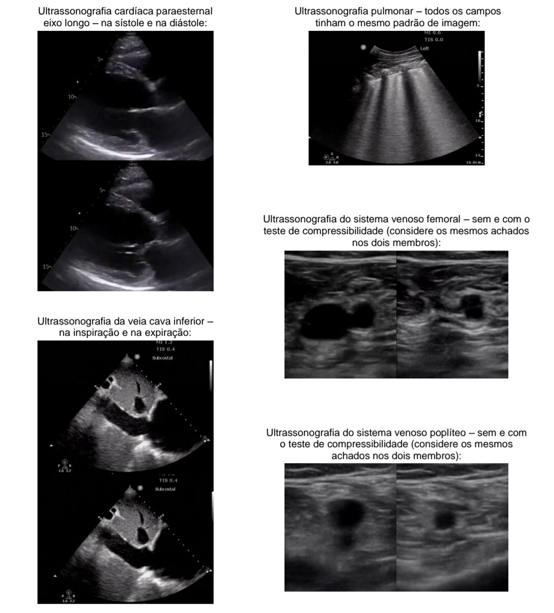 Ultrassonografias