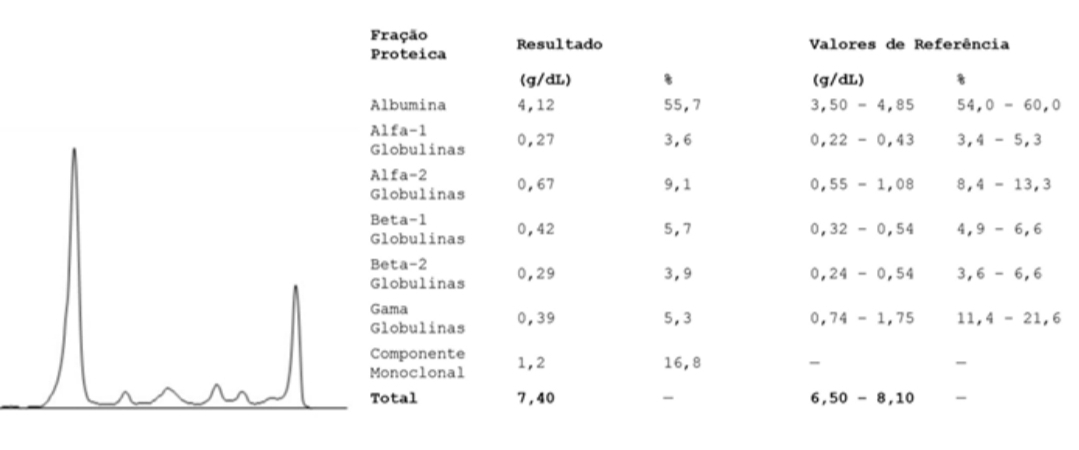 Eletroforese de proteínas